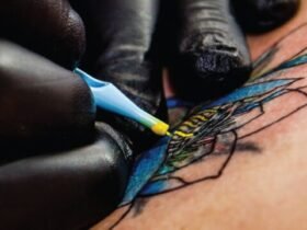 How to Remove Colored Ink Tattoos