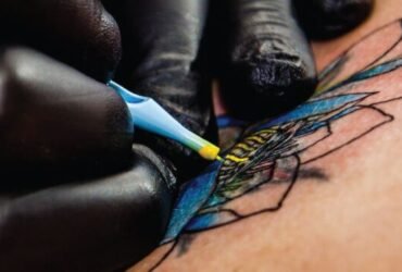 How to Remove Colored Ink Tattoos